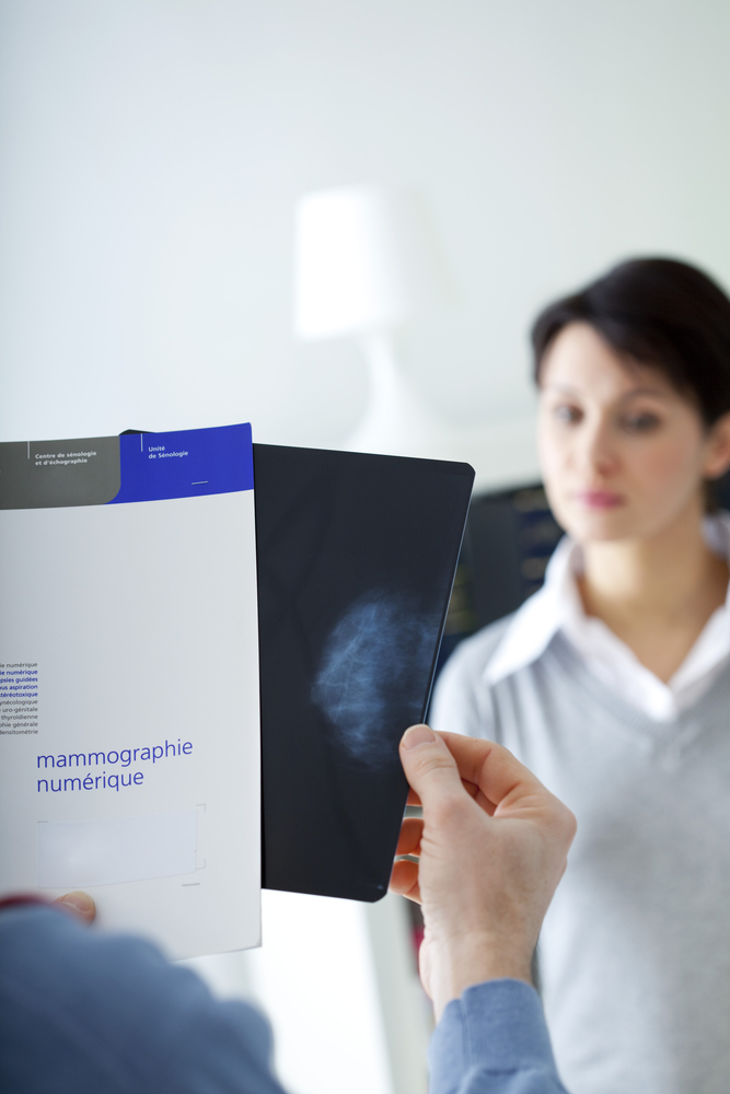 Come prevenire il tumore al seno - in collaborazione con LILT