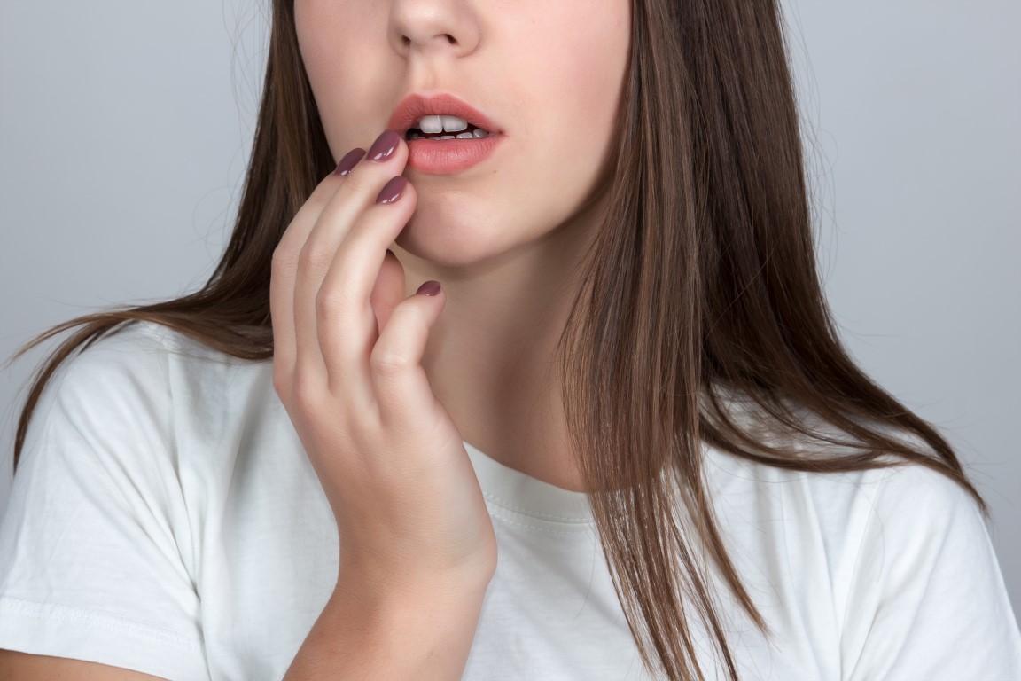 Herpes labiale: i rimedi naturali veloci per farlo passare