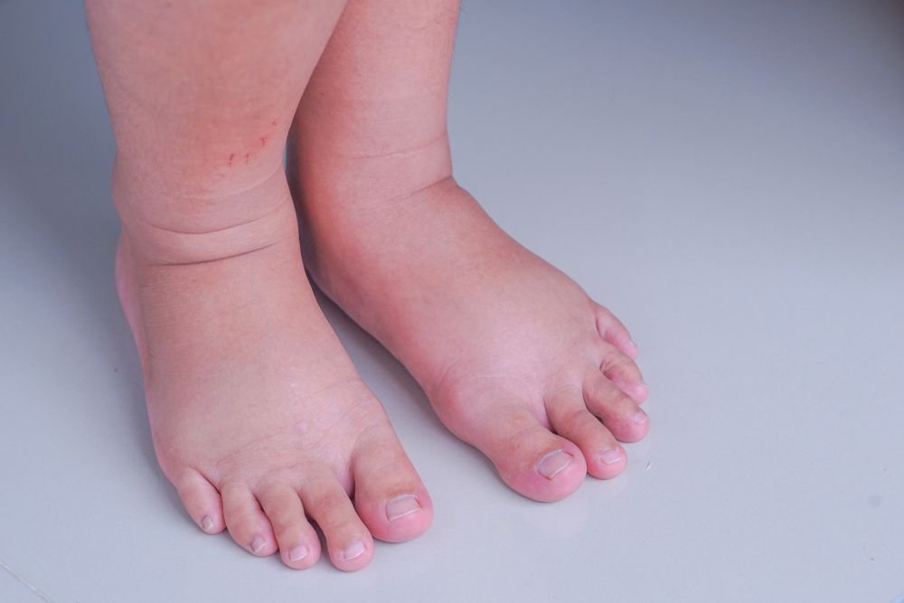 Cosa fare se il bambino cammina con i piedi verso l'interno?
