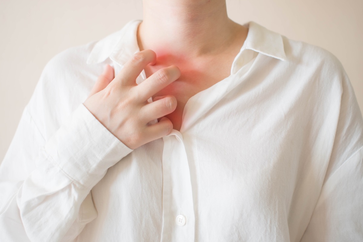 Dermatite da sudore: i rimedi naturali per un sollievo veloce