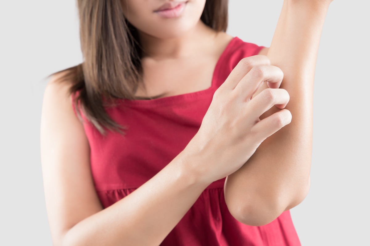 Prurito a gambe e braccia: i rimedi naturali da provare