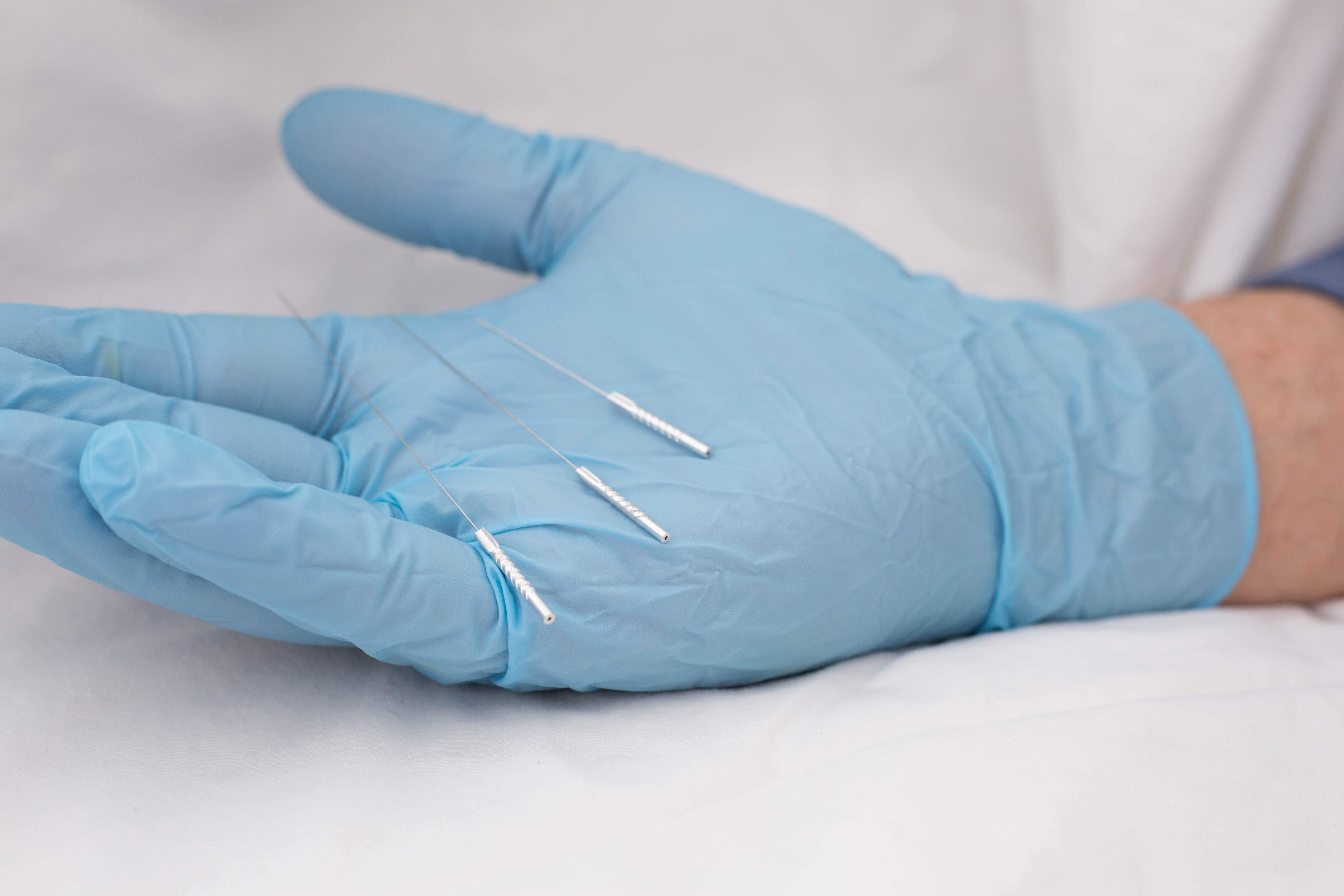 Che cos'è la dry needling, l’alternativa all’agopuntura