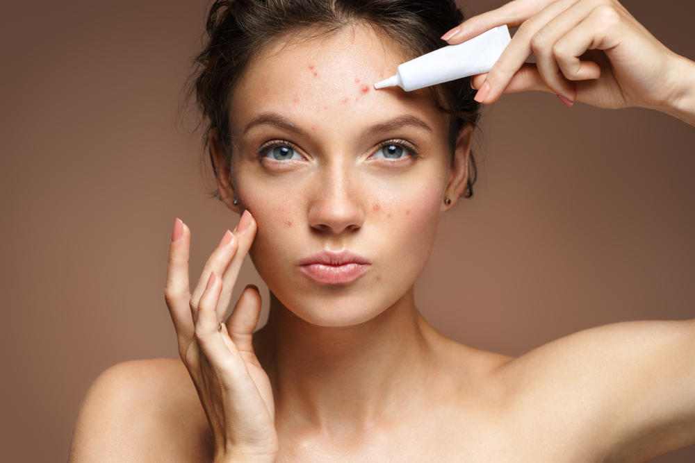 Acne in inverno, da che cosa dipende?