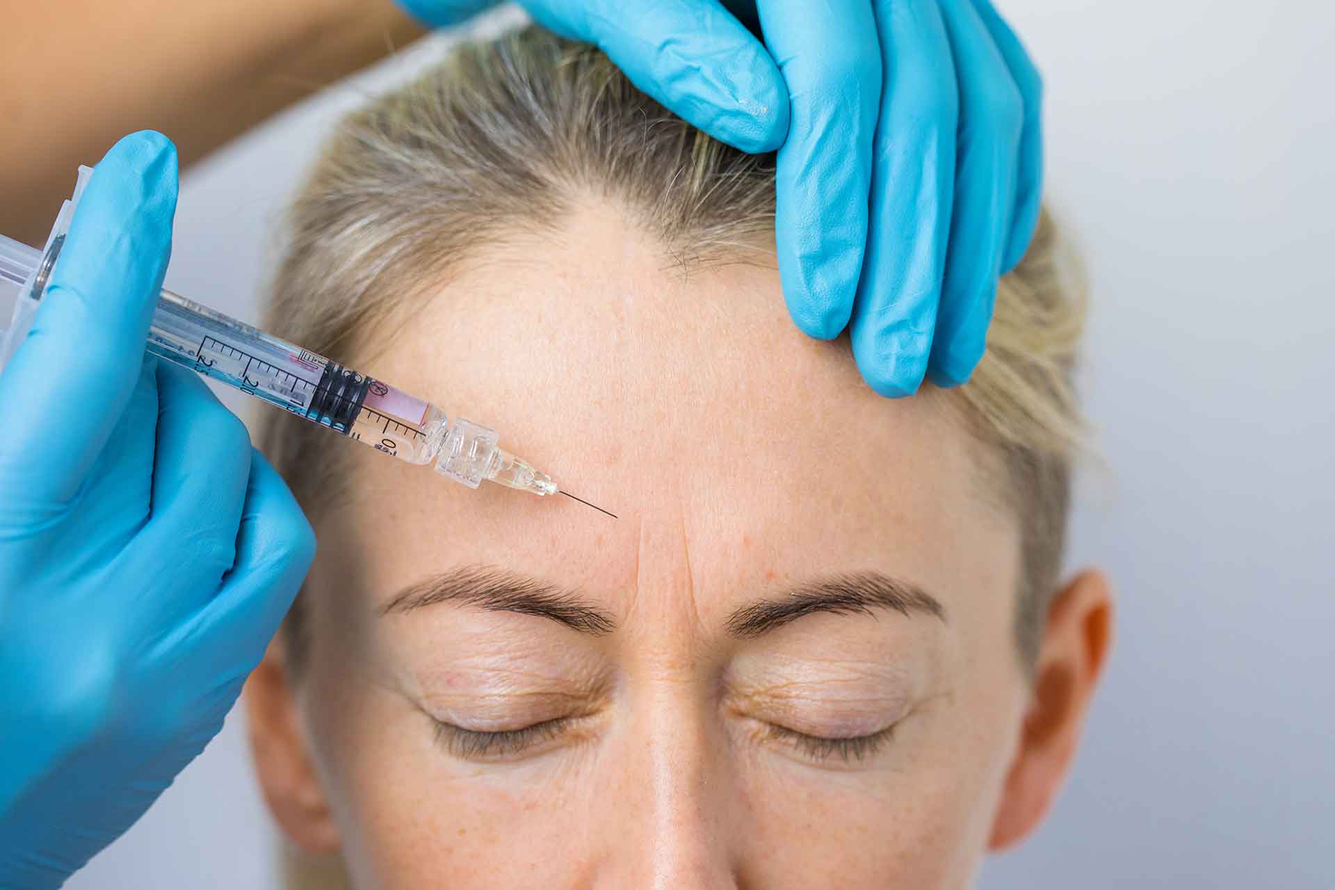 Botulino, gli usi estetici e non solo