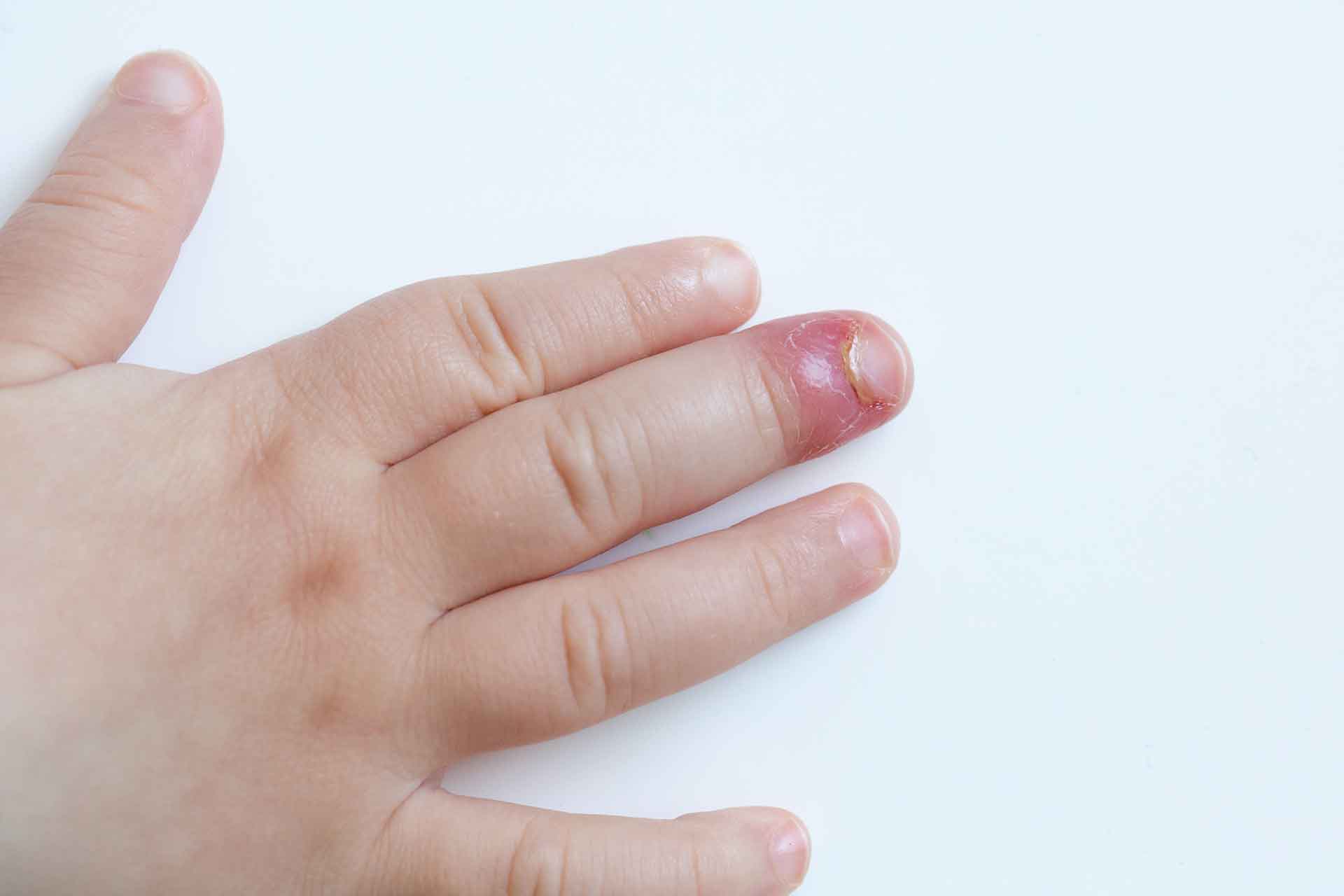 Come far passare il giradito ai bambini