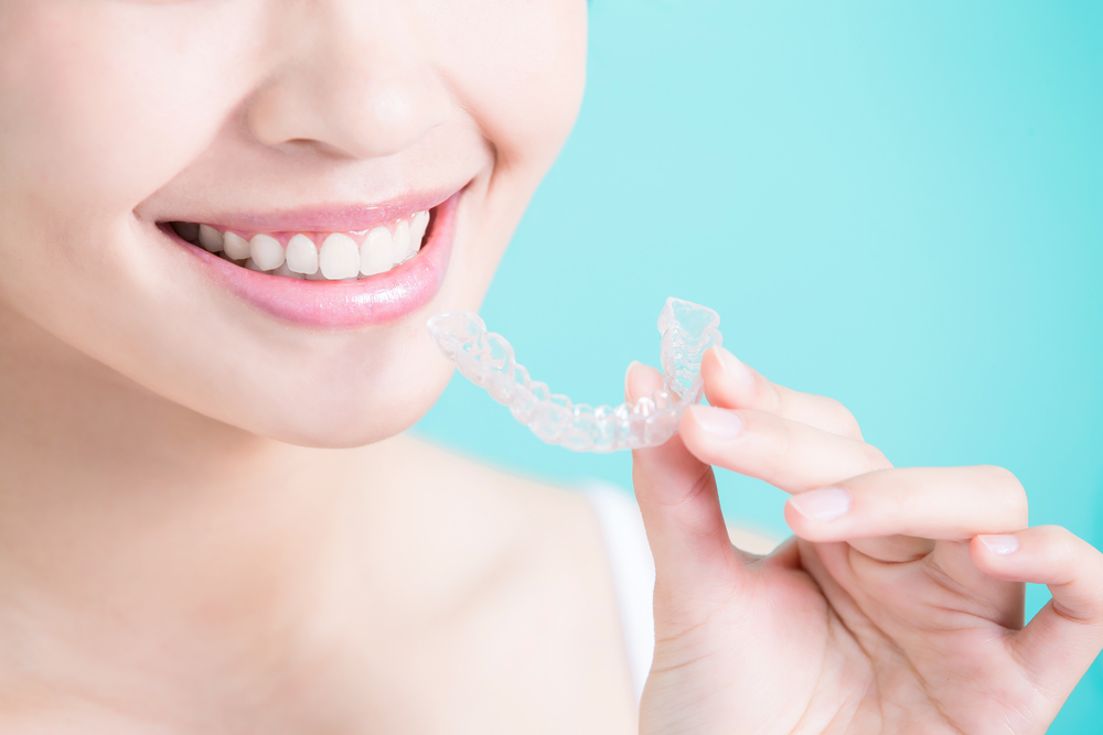 Bite dentale: consigli su perchè e quando usarlo