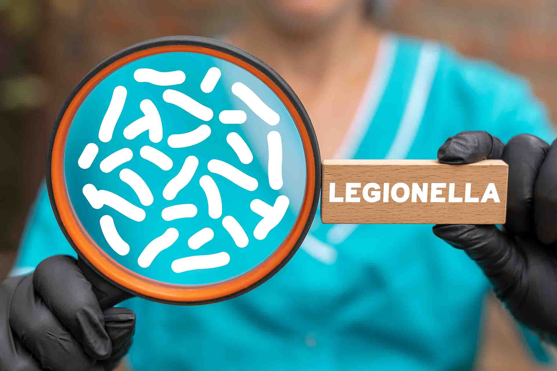 Legionella: i sintomi da riconoscere subito