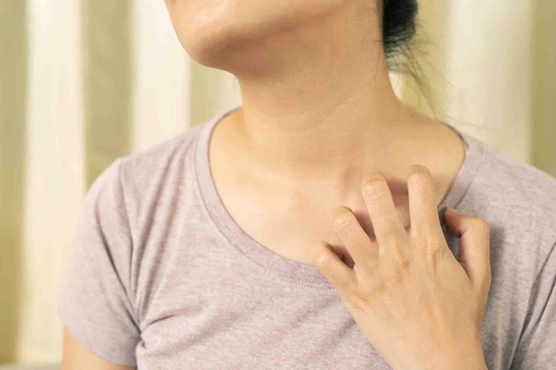 Cos'è il Patch test e a cosa serve