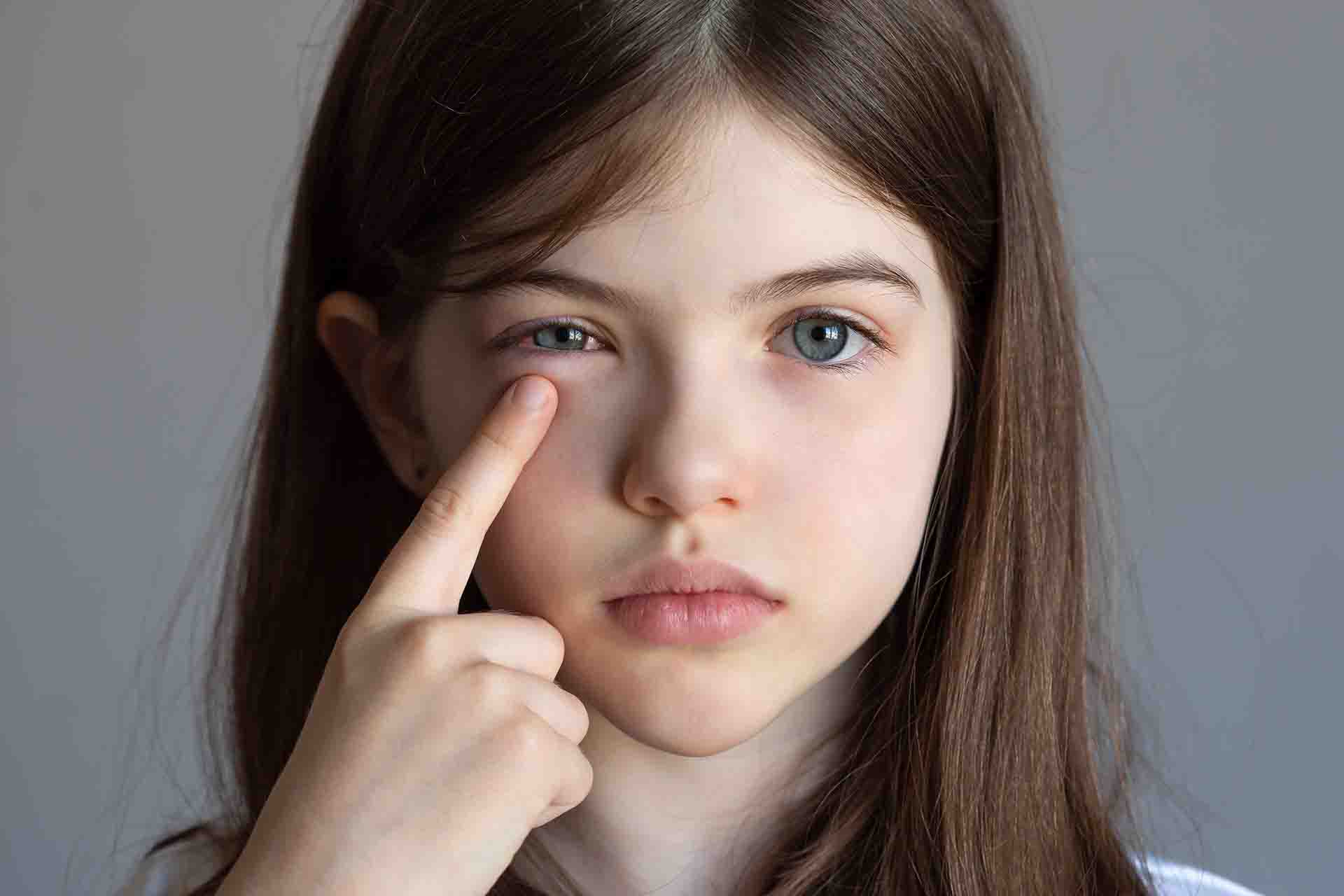 Cosa fare in caso di congiuntivite nei bambini