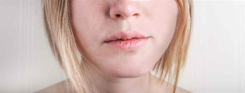 9 motivi per cui le labbra si screpolano