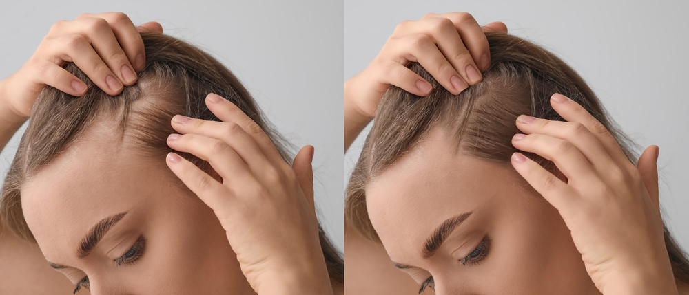 Perché i capelli non crescono?