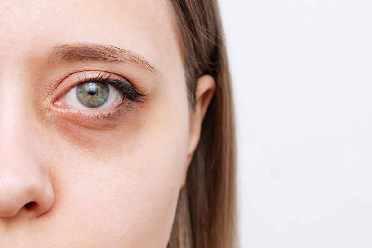Cosa fare quando si è pallidi?