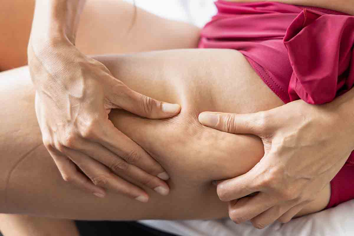 Come funzionano le creme anticellulite?