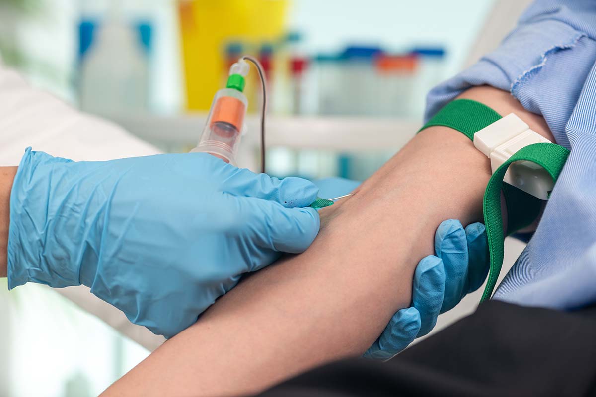Ogni quanto fare le analisi del sangue