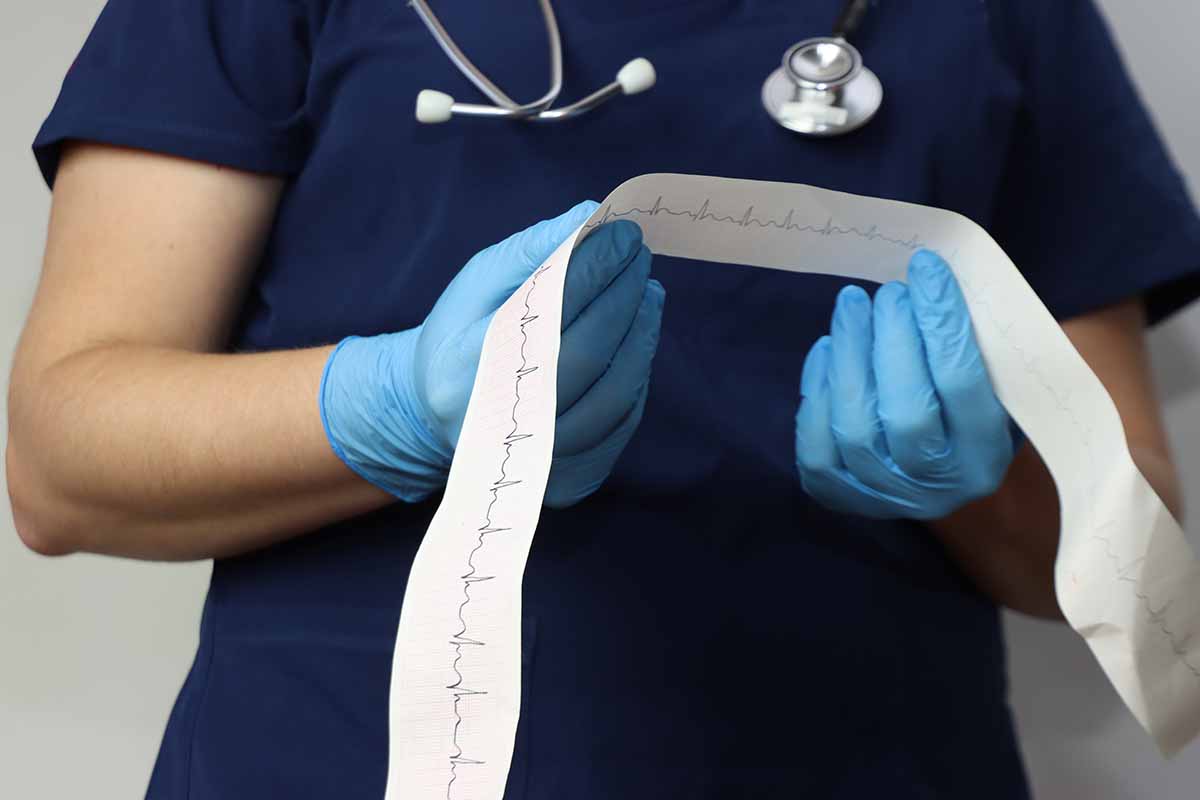Tachicardia: cos'è, i sintomi, le cause, le cure