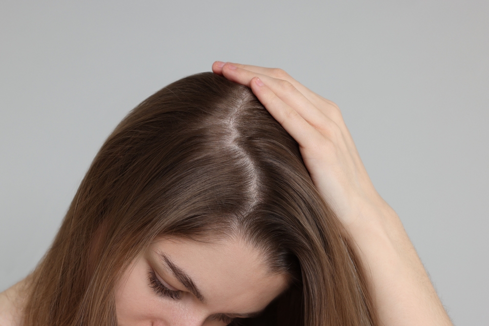 Come prendersi cura del tuo cuoio capelluto